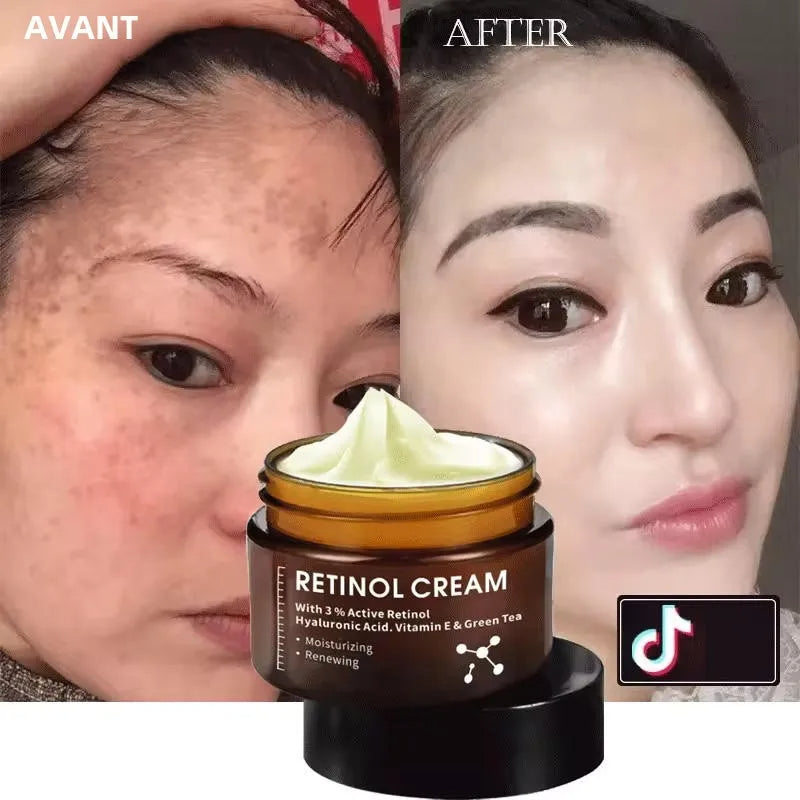 CREME ANTI AGE