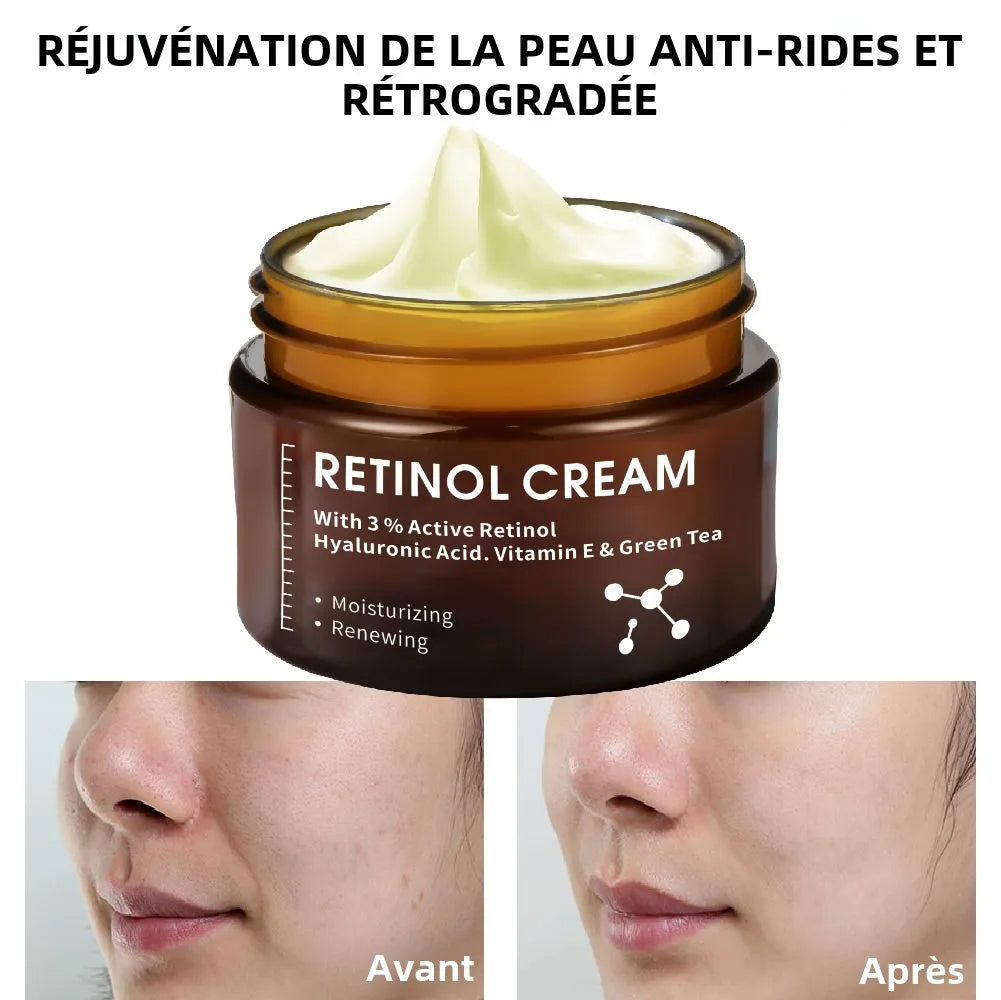 CREME ANTI AGE