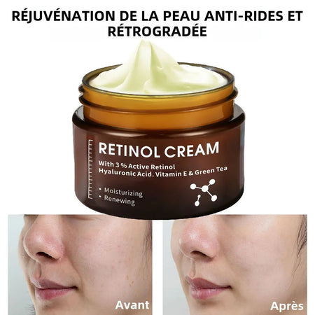 CREME ANTI AGE