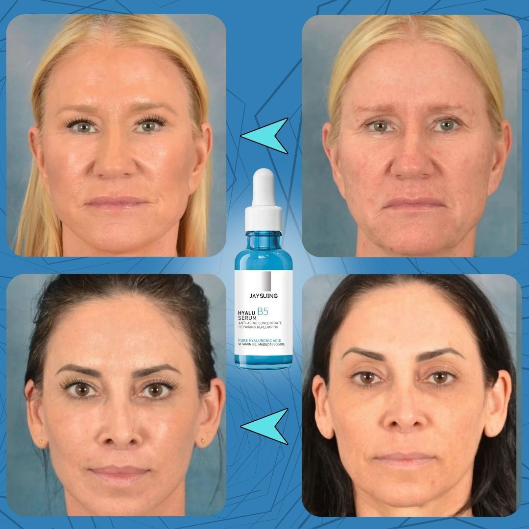 Sérum Hyalu B5 concentré anti-âge